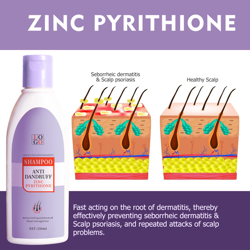 抗フケシャンプー ザンク ピリチオン 製造工場 OEM