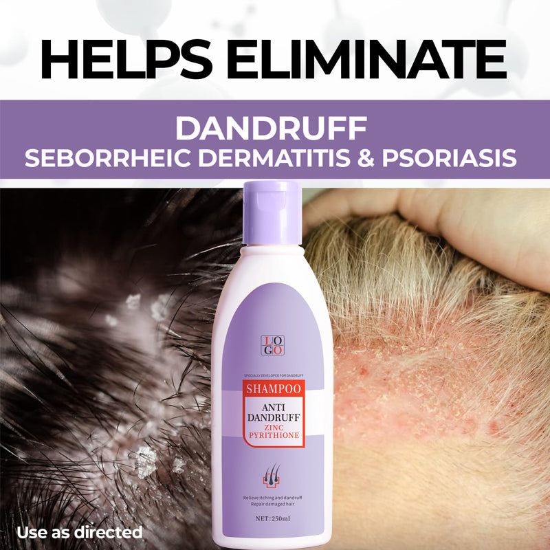 抗フケシャンプー ザンク ピリチオン 製造工場 OEM