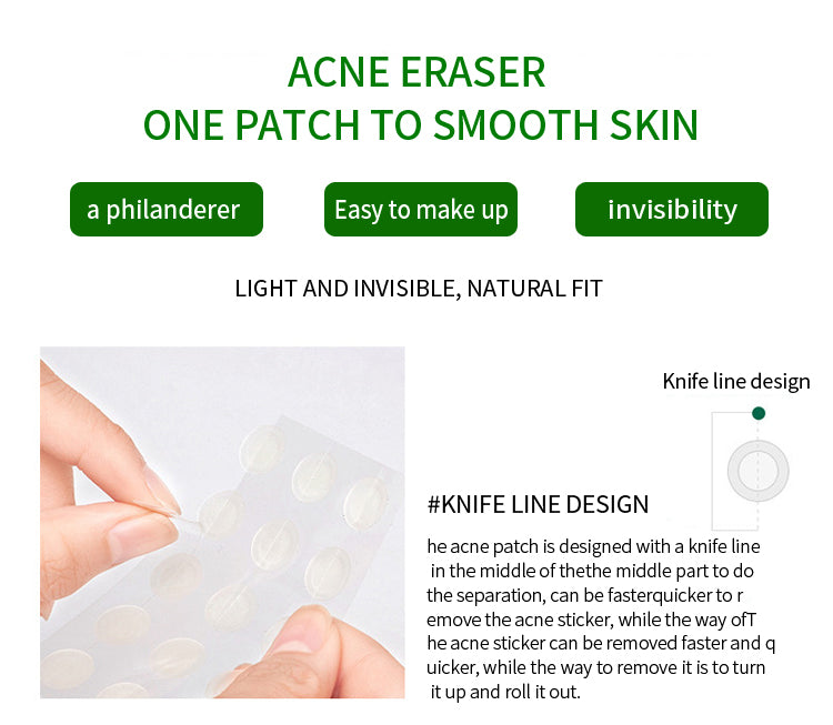 Patch d'acné personnalisé, maquillage imperméable, invisible et facile à appliquer, fabricant source, patch d'acné, traitement OEM