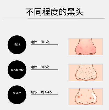 Masque anti-déchirure pour le nettoyage des points noirs, traitement personnalisé, fabricant OEM