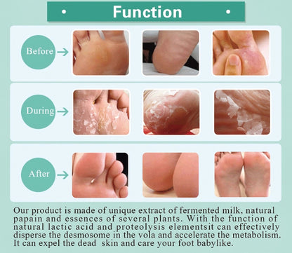 Masque de pied soins des pieds soins de la peau usine cosmétiques traitement personnalisé OEM